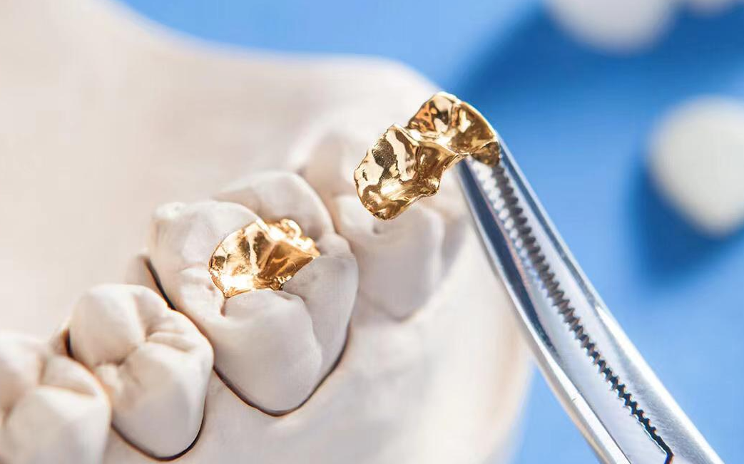 牙科材料硅胶怎么用如果你要做坏牙修复! 牙医告诉你怎么选材料和方案_https://www.jmylbn.com_新闻资讯_第9张