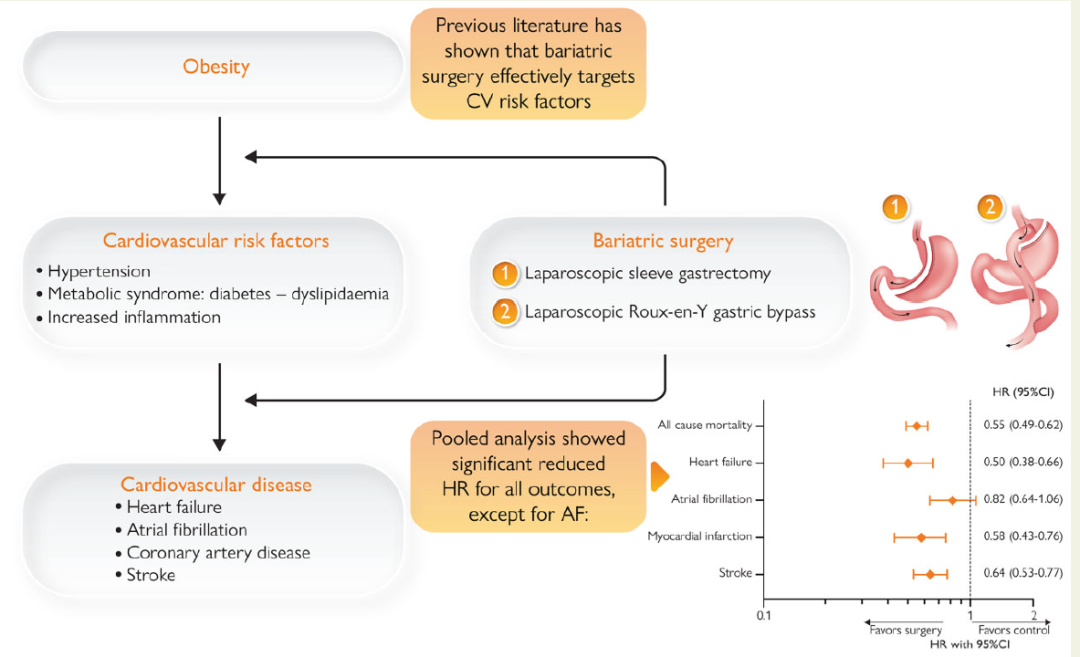 減肥手術多少錢_手術減肥_減肥手術是怎么做的