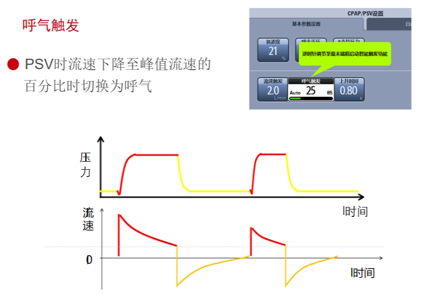 呼吸机ac是什么意思有创呼吸机模式下的参数及其意义_https://www.jmylbn.com_新闻资讯_第9张