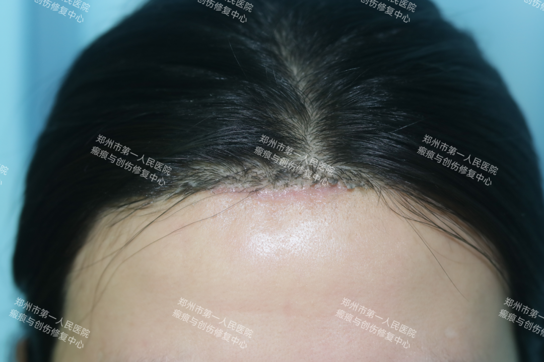 医生为什么缝合不用细线天衣无缝！“医”路相伴，急诊美容缝合对每一个伤口都温柔以待！_https://www.jmylbn.com_新闻资讯_第16张