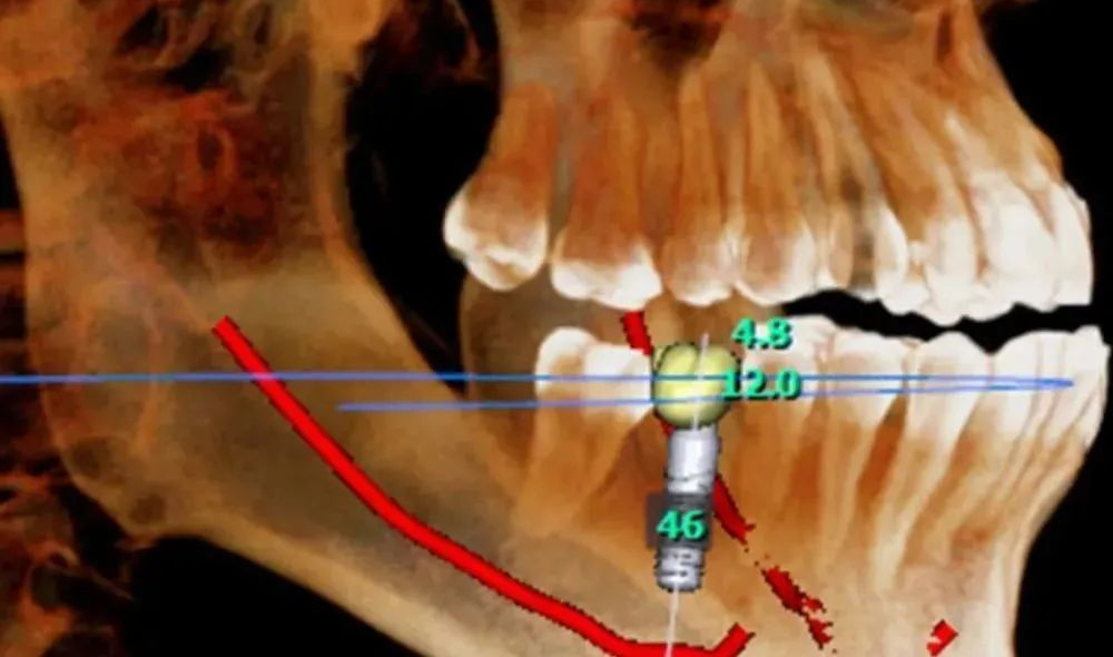口腔ct怎么拍摄【专科天地】没有口腔CT，你根本不会想到自己的牙齿长得多“奇葩”！_https://www.jmylbn.com_新闻资讯_第17张