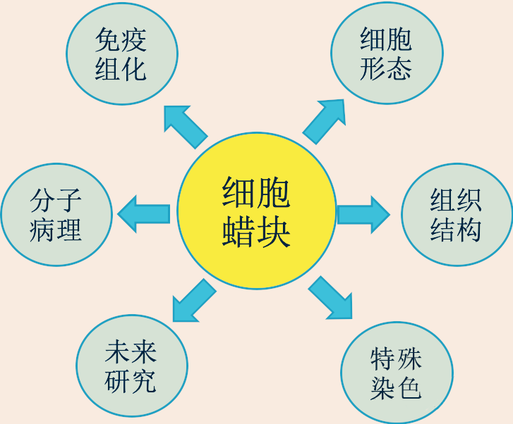 什么是病理蜡块【病理技术分享】精确诊断添利器胸腹水细胞蜡块_https://www.jmylbn.com_新闻资讯_第4张