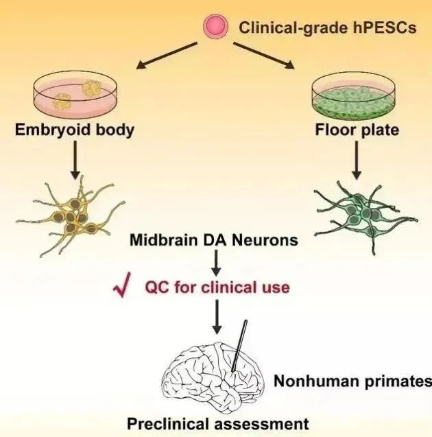 正式批准：12月开始静脉和脊髓腔注射干细胞治疗帕金森病(图7)