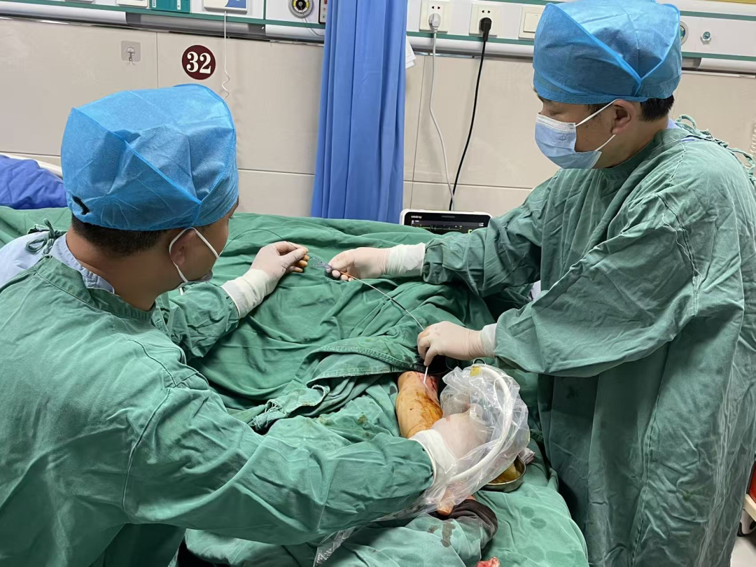 竹溪县中医医院成功开展首例动静脉内瘘球囊扩张术