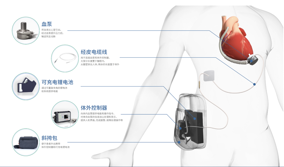 中国哪些医疗设备国产权威发布！2023十大自主创新医疗器械_https://www.jmylbn.com_新闻资讯_第43张