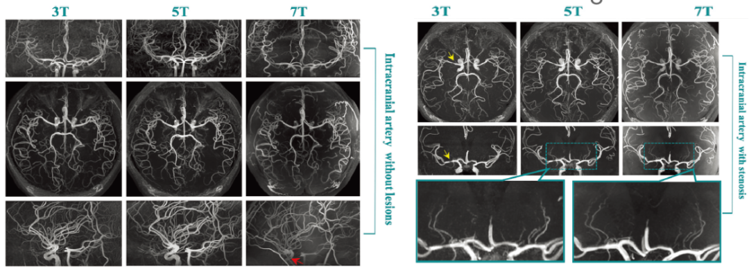 中国哪些医疗设备国产权威发布！2023十大自主创新医疗器械_https://www.jmylbn.com_新闻资讯_第9张