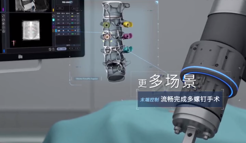 中国哪些医疗设备国产权威发布！2023十大自主创新医疗器械_https://www.jmylbn.com_新闻资讯_第22张