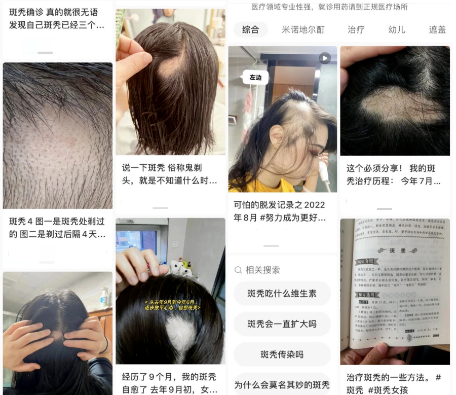 秃头神药，辉瑞专供有钱人