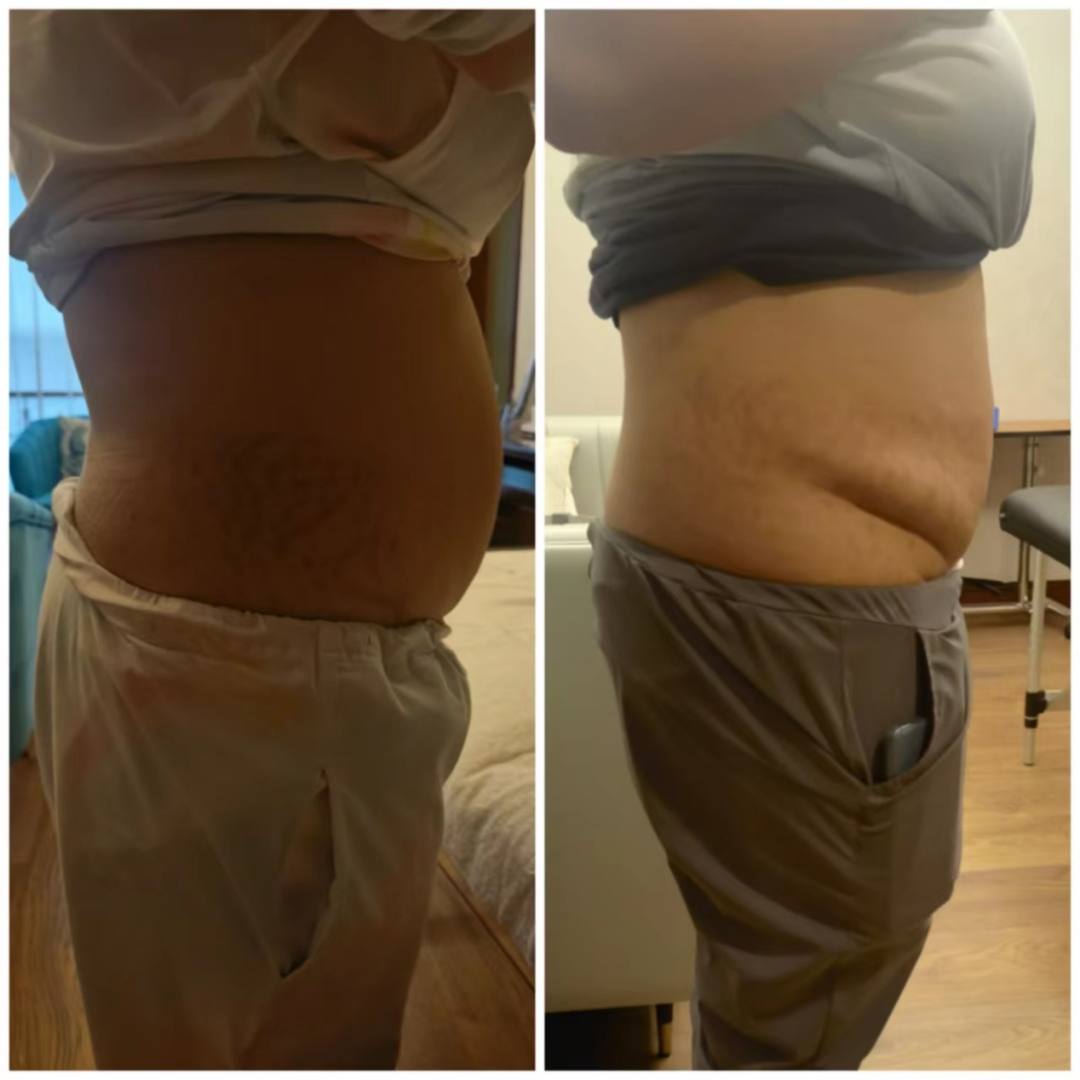 怀孕，这是我没想到的