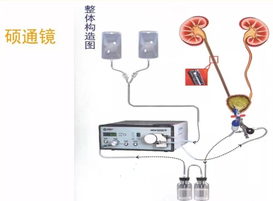 输尿管硬镜有哪些牌子【新技术】认识硕通镜_https://www.jmylbn.com_新闻资讯_第2张