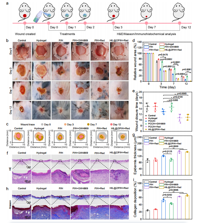 Nature Communications原位水凝胶喷剂——术后肿瘤复发转移和伤口愈合治疗新工具