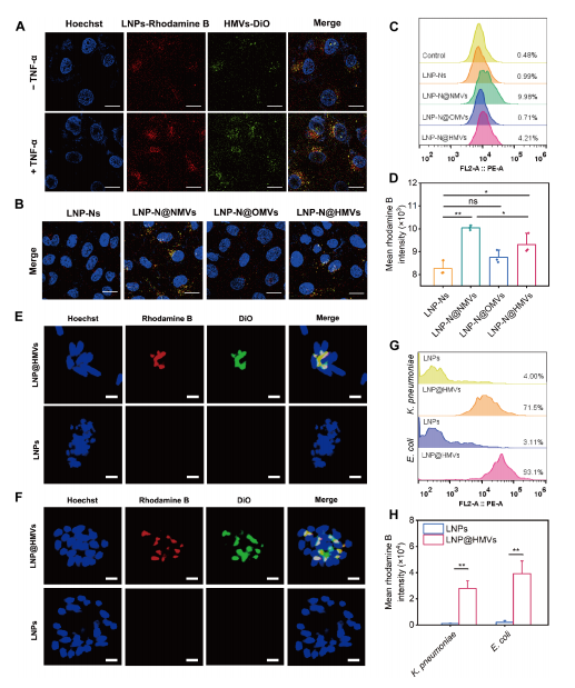 Sci Adv: 细胞膜功能化载药脂质纳米粒：双靶向、高效抗菌、激活免疫
