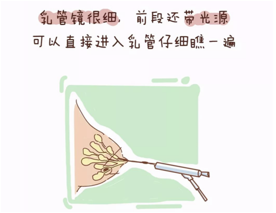 乳腺定位针怎么放一探“究竟” 镜艺“求精”：江阴市中医院开展乳管镜检查项目_https://www.jmylbn.com_新闻资讯_第6张