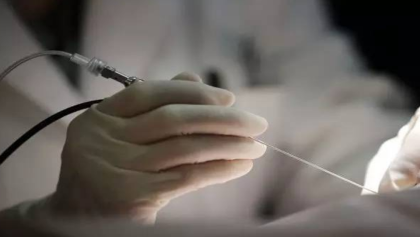 乳腺定位针怎么放一探“究竟” 镜艺“求精”：江阴市中医院开展乳管镜检查项目_https://www.jmylbn.com_新闻资讯_第11张