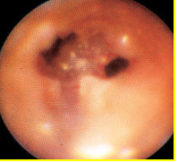 乳腺定位针怎么放一探“究竟” 镜艺“求精”：江阴市中医院开展乳管镜检查项目_https://www.jmylbn.com_新闻资讯_第20张