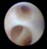 乳腺定位针怎么放一探“究竟” 镜艺“求精”：江阴市中医院开展乳管镜检查项目_https://www.jmylbn.com_新闻资讯_第13张