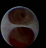 乳腺定位针怎么放一探“究竟” 镜艺“求精”：江阴市中医院开展乳管镜检查项目_https://www.jmylbn.com_新闻资讯_第14张