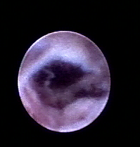 乳腺定位针怎么放一探“究竟” 镜艺“求精”：江阴市中医院开展乳管镜检查项目_https://www.jmylbn.com_新闻资讯_第15张