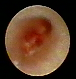 乳腺定位针怎么放一探“究竟” 镜艺“求精”：江阴市中医院开展乳管镜检查项目_https://www.jmylbn.com_新闻资讯_第18张