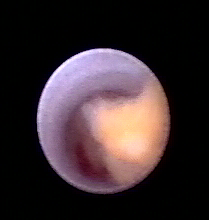 乳腺定位针怎么放一探“究竟” 镜艺“求精”：江阴市中医院开展乳管镜检查项目_https://www.jmylbn.com_新闻资讯_第17张