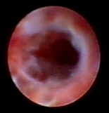 乳腺定位针怎么放一探“究竟” 镜艺“求精”：江阴市中医院开展乳管镜检查项目_https://www.jmylbn.com_新闻资讯_第16张