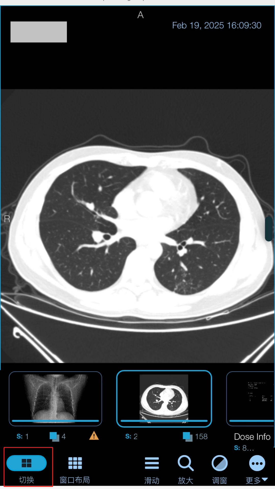 放射科怎么打印便民服务｜放射科“云胶片”上线了，可随时随地查看影像数据_https://www.jmylbn.com_新闻资讯_第9张