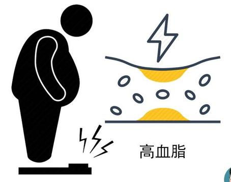 【干货】他汀类药物使用必备知识！