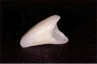 近些年大火的BOPT预备技术技术，你真的会吗？