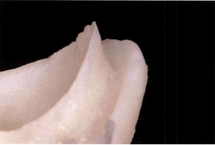 近些年大火的BOPT预备技术技术，你真的会吗？