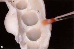 近些年大火的BOPT预备技术技术，你真的会吗？