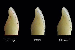 近些年大火的BOPT预备技术技术，你真的会吗？