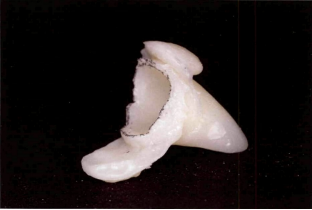 近些年大火的BOPT预备技术技术，你真的会吗？