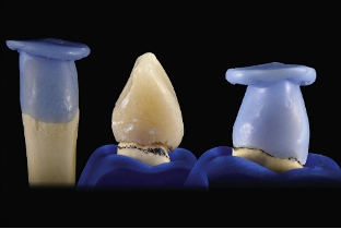 近些年大火的BOPT预备技术技术，你真的会吗？