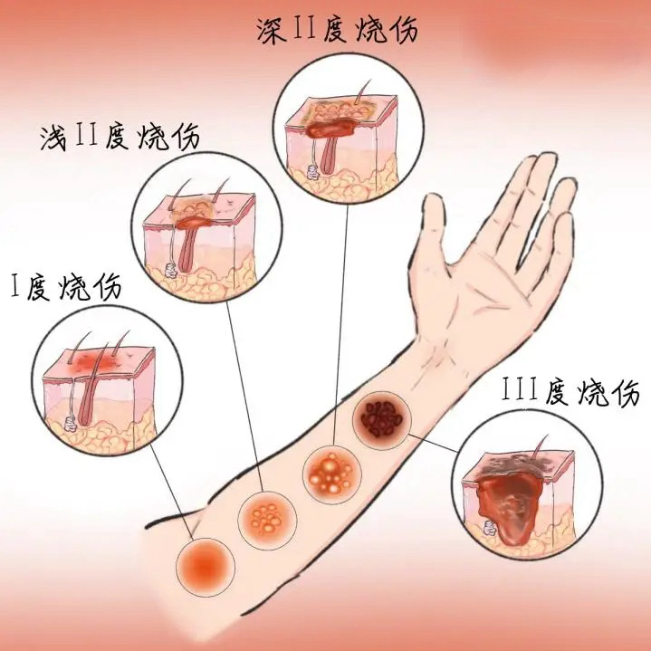 纱布绷带怎么用【健康365】超实用！包扎的正确打开方式，赶紧学起来！_https://www.jmylbn.com_新闻资讯_第24张