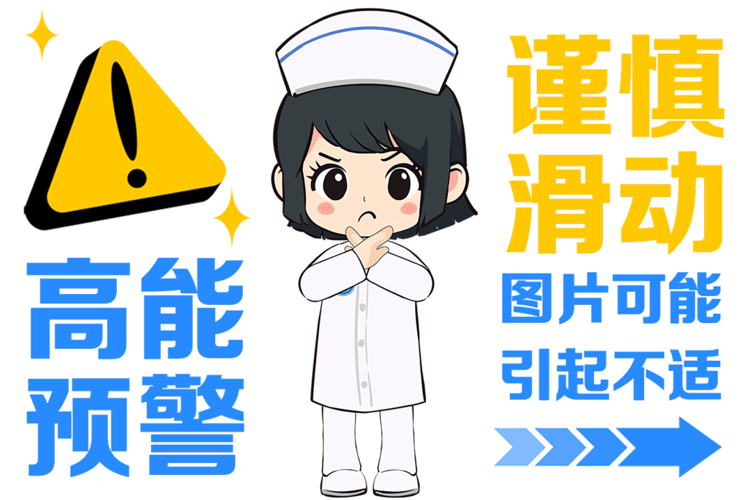 纱布绷带怎么用【健康365】超实用！包扎的正确打开方式，赶紧学起来！_https://www.jmylbn.com_新闻资讯_第37张