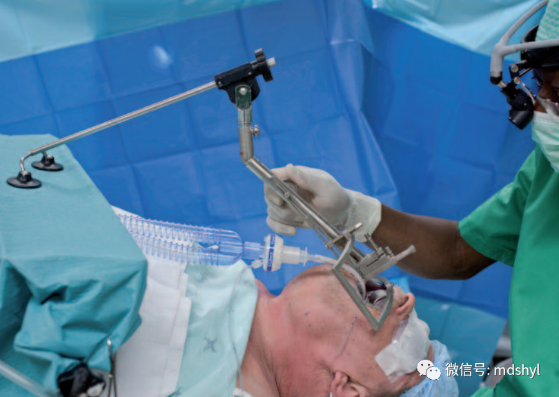 耳鼻喉治疗台怎么消毒麦迪生医疗‖耳鼻喉科相关常用高值耗材大全_https://www.jmylbn.com_新闻资讯_第91张