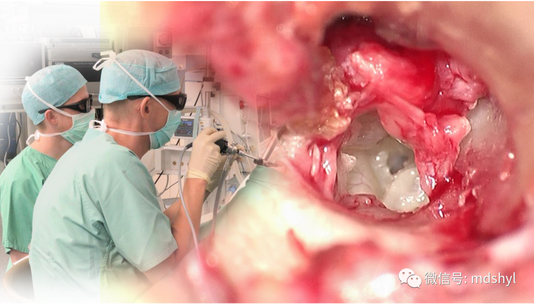 耳鼻喉治疗台怎么消毒麦迪生医疗‖耳鼻喉科相关常用高值耗材大全_https://www.jmylbn.com_新闻资讯_第77张