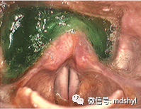 普通喉镜怎么使用如何避免动态电子喉镜误当普通电子喉镜使用？_https://www.jmylbn.com_新闻资讯_第28张