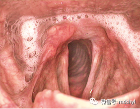 普通喉镜怎么使用如何避免动态电子喉镜误当普通电子喉镜使用？_https://www.jmylbn.com_新闻资讯_第27张