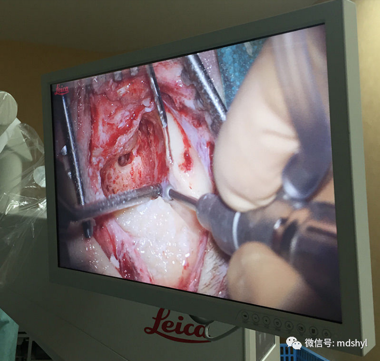 耳鼻喉治疗台怎么消毒麦迪生医疗‖耳鼻喉科相关常用高值耗材大全_https://www.jmylbn.com_新闻资讯_第115张