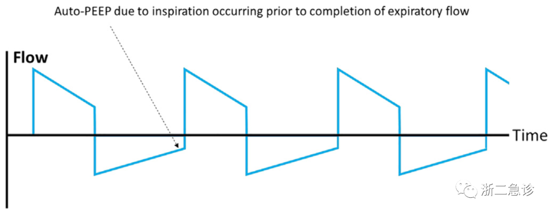 呼吸机f什么意思呼吸机还是搞不懂？机械通气的基本模式，这里全总结好了！_https://www.jmylbn.com_新闻资讯_第9张