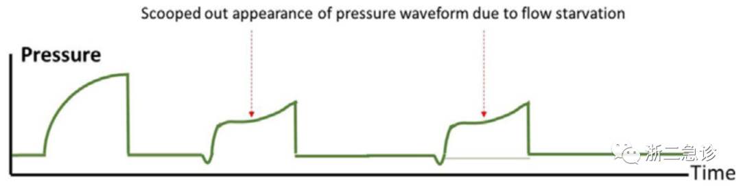 呼吸机f什么意思呼吸机还是搞不懂？机械通气的基本模式，这里全总结好了！_https://www.jmylbn.com_新闻资讯_第14张