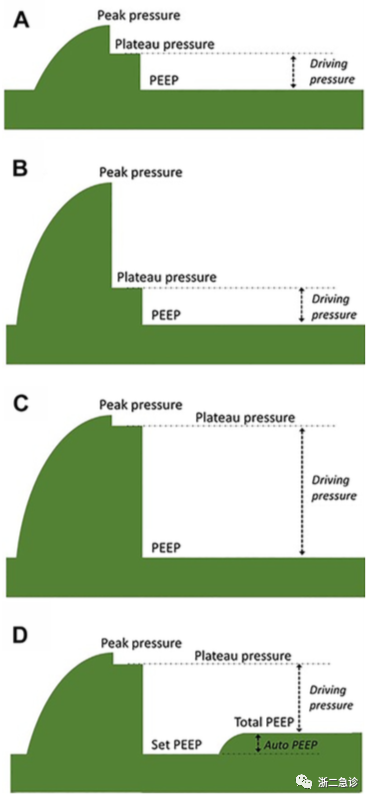呼吸机f什么意思呼吸机还是搞不懂？机械通气的基本模式，这里全总结好了！_https://www.jmylbn.com_新闻资讯_第8张