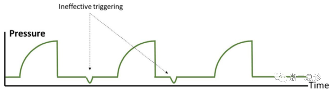 呼吸机f什么意思呼吸机还是搞不懂？机械通气的基本模式，这里全总结好了！_https://www.jmylbn.com_新闻资讯_第15张