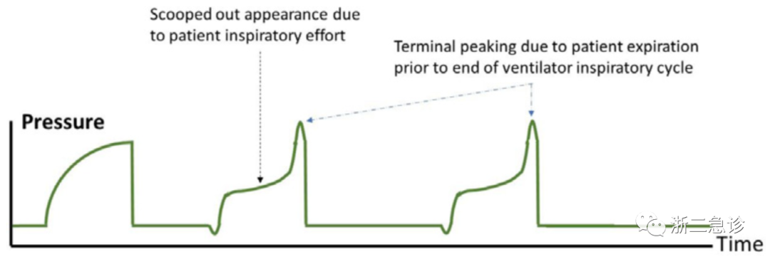 呼吸机f什么意思呼吸机还是搞不懂？机械通气的基本模式，这里全总结好了！_https://www.jmylbn.com_新闻资讯_第17张