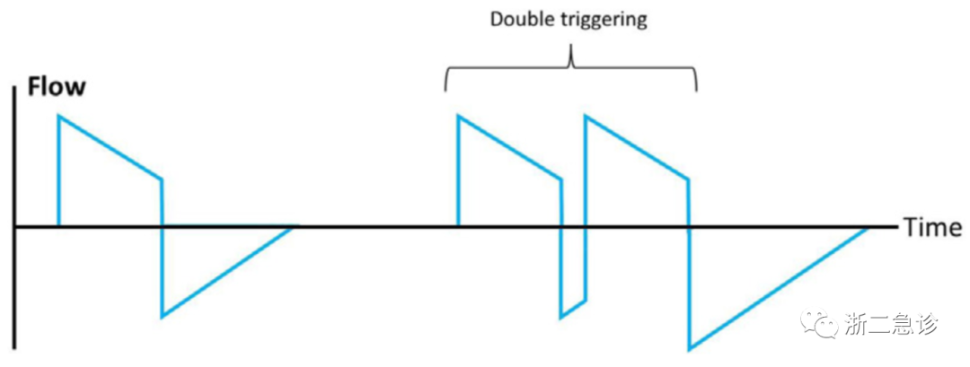 呼吸机f什么意思呼吸机还是搞不懂？机械通气的基本模式，这里全总结好了！_https://www.jmylbn.com_新闻资讯_第16张