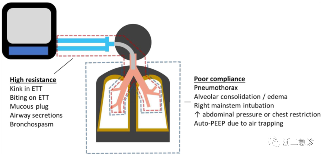 呼吸机f什么意思呼吸机还是搞不懂？机械通气的基本模式，这里全总结好了！_https://www.jmylbn.com_新闻资讯_第2张
