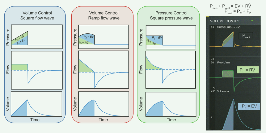 为什么成人呼吸机用容控呼吸机波形解析 ｜ 容控_https://www.jmylbn.com_新闻资讯_第3张