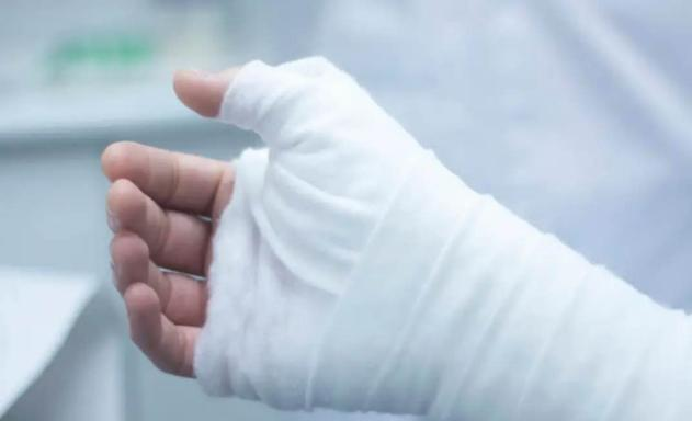 聚酯石膏怎么打骨折后打了石膏要注意什么？一文揭晓！_https://www.jmylbn.com_新闻资讯_第2张