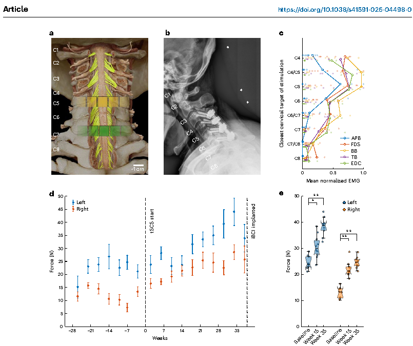 Figure 2. 经皮脊髓刺激的电极定位、肌肉募集图谱及双侧肘屈曲力量的纵向变化。